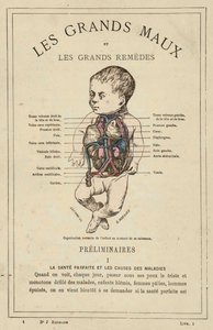 Lapsen normaali organisaatio syntymähetkellä (väri litho) tekijältä French School