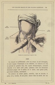 Lansetin asento käsivarressa (väri litho) tekijältä French School