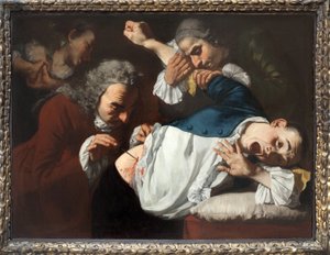 Operaatio. Gaspare Traversin maalaus (n. 1722-1770), öljy kankaalle, n. 1753-1754. Italialainen taide 1700-luvulta. Staatsgalerie Stuttgart (Saksa).
