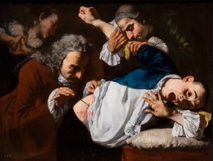 Operaatio, noin 1753/54 (Öljy kankaalle) tekijältä Gaspare Traversi