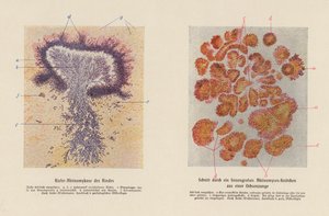 Actinomyces bovis (väri litografia) tekijältä German School