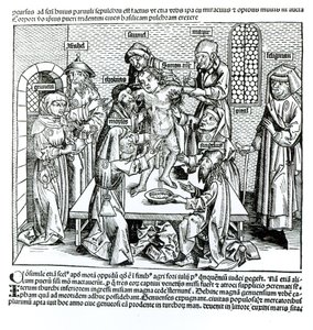 Ympärileikkaus, Hartmann Schedelin (1440-1514) teoksesta "Liber Chronicarum" tekijältä German School