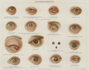Silmäsairaudet (väri litho) tekijältä German School