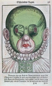 Naamio karsastuksen hoitoon, Georg Bartischin (1535-1636) Ophthalmodouleiasta, joka julkaistiin Dresdenissä vuonna 1583 (värillinen puupainatus) tekijältä German School