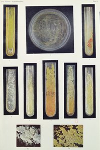 Syphilis Bacillus, Max von Niessenin kirjasta Leipzig, 1908 tekijältä German School