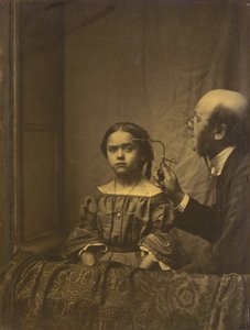 Tarkkaavaisuuslihas (vasemmalla); kirkkaan valon aiheuttama kulmakarvojen supistuminen (oikealla), 1854-1856, painettu 1862 (kuva).