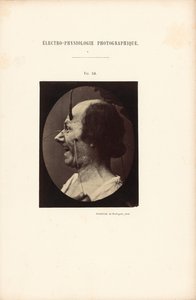 Valokuvasähköfysiologia, kuva 39. tekijältä Guillaume Benjamin Duchenne