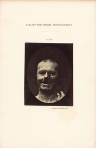 Valokuvasähköfysiologia, kuva 53. tekijältä Guillaume Benjamin Duchenne
