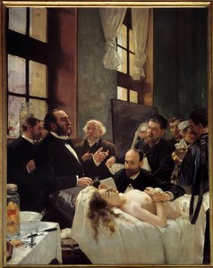 Tohtori Jules Emile (Jules-Emile) Pean (1830-1898) opetti Saint Louisin sairaalassa löytöään laivojen puristamisesta eli "" Ennen leikkausta"" Henri Gervexin (1852-1929) maalaus 1887 su. 2,42 x 1,88 m Pariisi, musee d
