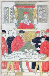 Dissektio, kuvitus Johannes de Kethamin (d.c.1490) Fasciculus Medicinaesta 1493 (puupiirros) tekijältä Italian School