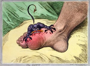 The Gout, julkaissut Hannah Humphrey vuonna 1799 (käsinvärinen softdground-etsaus)