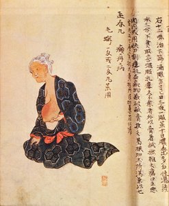Ensimmäinen rintasyövän kirurginen hoito, jonka suoritti Seishu Hanaoka (1760-1836) yleisanestesiassa vuonna 1804 tekijältä Japanese School