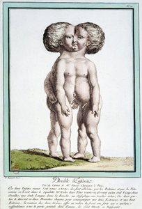 Siamilaiset lapset - Régnaultin "" Luonnon poikkeamat" -osassa tekijältä Jean Baptiste Regnault