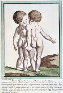 Siamilaiset lapset - Régnaultin "" Luonnon poikkeamat" -osassa tekijältä Jean Baptiste Regnault
