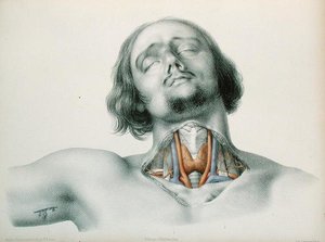 Poikkileikkaus kurkusta Jean-Baptiste-Leon Dubreuilin teoksesta Anomalies Arterielles