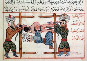 Murtuman vähentäminen. Miniatyyri Sharaf al-dinin turkkilaisen lääketieteen kohteesta tekijältä Ottoman School