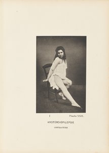 Hystero-epilepsiakontraktuura tekijältä Paul Marie Léon Regnard