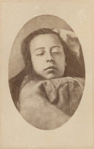 Hysteriakohtaus, toinen vaihe, kuvitus Bournevillen ja P:n julkaisemasta "Iconographie Photographique de La Salpetriere". Regnard, levy III, Pariisi, 1876 (valkopainatus). tekijältä Paul Regnard