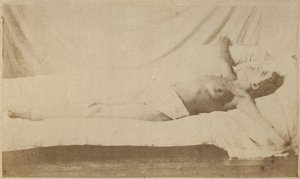 Hysteerinen epilepsia, kohtaus, ristiinnaulitseminen, levy VI julkaisusta "Iconographie Photographique de La Salpetriere", Bourneville et P. Regnard, Paris, 1876 (albumiprintti)