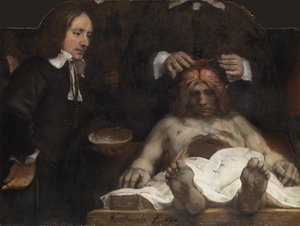 Tohtori Jan Deymanin anatomian oppitunti, 1656 tekijältä Rembrandt van Rijn