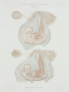 Gynekologia Ihmissikiö 40 päivän ikäisenä, c 1847-1859 tekijältä John Pardon