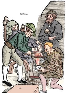 Jalan amputointi ilman nukutusta, 1593 tekijältä Unbekannt
