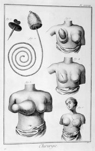 Rintaleikkaus, 1751-1777 tekijältä Unbekannt