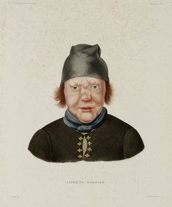 Sairaudet, Lepra Naaraspitaalinen, Islanti, 1800-luvun alku tekijältä Unbekannt