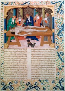Dissektio, 1400-luvun loppu tekijältä Unbekannt