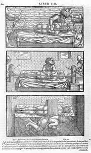 Kuvitus Avicennasta, 1556 tekijältä Unbekannt