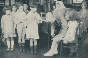 Polvilumpion refleksin testaus hermostosairauden varalta, c1935 tekijältä Unbekannt