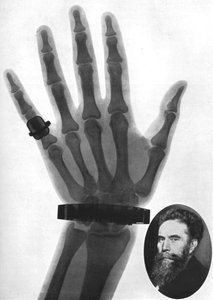 Röntgenkuva kädestä, 1926 tekijältä Unbekannt