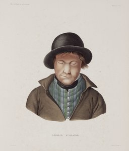Sairaudet, Lepra Mies spitaalinen, Islanti, 1800-luvun alku tekijältä Unbekannt
