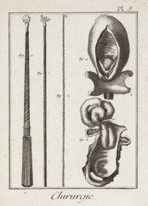 Laitteet, Early-Modern Kirurgiset instrumentit ja kaaviot kehon osista tekijältä Unbekannt