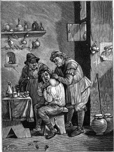 Karlataanikirurgi 1700-luvulla tutkimassa olkapäävammaa. (Ajan kaiverruksesta). Kaiverrus "" La Nature: revue des sciences et de leurs applications aux arts et a l