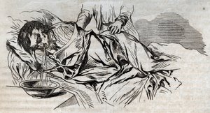 Onnettomuuslääketiede - tehokkaimmasta avustuksesta hukkuneille - pähkinävaipat kyljessä ja juomansa veden oksentaminen - kaiverrus "La Sante Universelle - Guide Medical des Familles" 1852 tekijältä Unknown artist