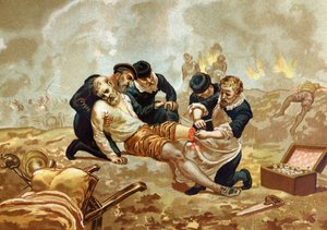 Ambroise Pare Medicine ja ranskalainen kirurgi (n. 1509-1590) harjoittavat valtimoiden ligaatiota amputaation jälkeen. of after hombres y Mujeres julkkikset. Barcelona 1877. tekijältä Unknown artist