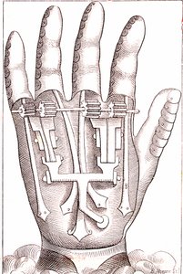 Ranskalaisen kirurgin anatomin Ambroise Parin keinotekoinen käsiproteesi tekijältä Unknown artist