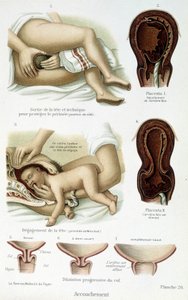 Synnytys - tiedelautakunta, 1800-luvun loppu tekijältä Unknown artist