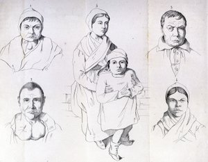 Morelin pohdintoja endeemisen kretinismin syistä. tekijältä Unknown artist