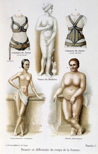 naisen kehon kauneus ja epämuodostumat (laiha ja lihavuus); Junon vyöt - elokuvassa "Nainen, kotilääkäri" tekijältä Unknown artist