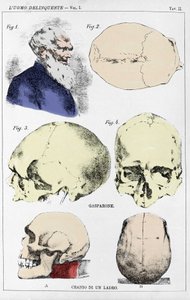 Italialaisen kriminologin tutkimus rikollisen kallon morfologiasta tekijältä Unknown artist