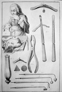 Kallon trepanaatio, erilaiset instrumentit (kaiverrus tekijältä Unknown artist