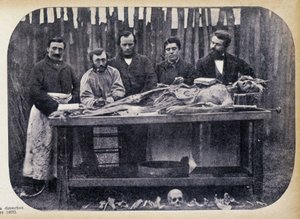 Dissection, v.1865. tekijältä Unknown photographer