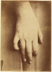 Tutkimus kädestä,1865 (kuva) tekijältä Unknown photographer