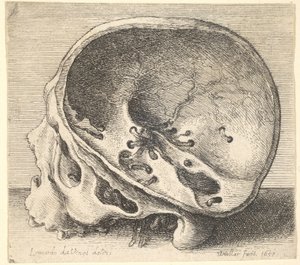 Leikattu kallo profiilissa vasemmalla, kallon vasen puoli poistettu, 1651. tekijältä Wenceslaus Hollar