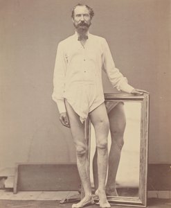 Vasemman reisiluun keskimmäisen kolmanneksen ampumahaava, 1865-67.