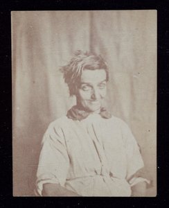 Psykiatria Potilaan muotokuva, Surrey County Asylum, n. 1852 tekijältä John Pardon