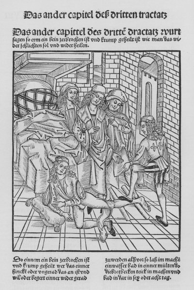 Kirurgian kirja, Hieronymus Brunschwig (litho) tekijältä (after) German School