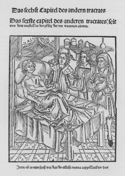 Hieronymus Brunschwigin Kirurgian kirja (litho) tekijältä (after) German School
